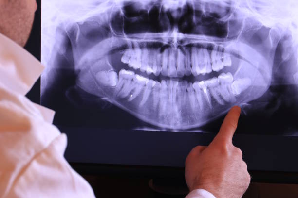 Best Walk-In Emergency Dentist in Yuipa, CA